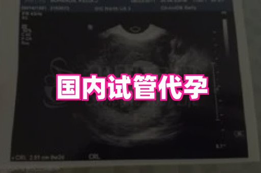 长春助孕网 4